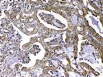 MMP16 Antibody in Immunohistochemistry (Paraffin) (IHC (P))