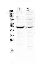 MMP16 Antibody in Western Blot (WB)