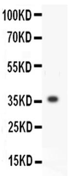 MMP3 Antibody in Western Blot (WB)