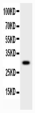 MMP7 Antibody in Western Blot (WB)