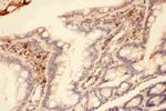 MMP7 Antibody in Immunohistochemistry (Paraffin) (IHC (P))