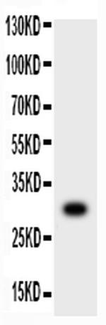 MMP7 Antibody in Western Blot (WB)