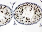 MNAT1 Antibody in Immunohistochemistry (Paraffin) (IHC (P))