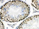 MNAT1 Antibody in Immunohistochemistry (Paraffin) (IHC (P))