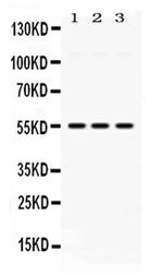 MPP1 Antibody in Western Blot (WB)