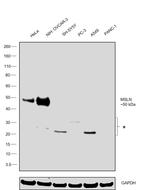 Mesothelin Antibody in Western Blot (WB)