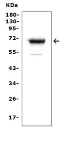 Mesothelin Antibody in Western Blot (WB)