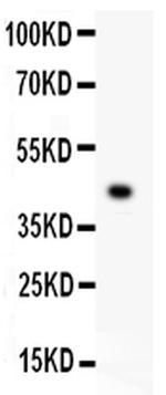 Mesothelin Antibody in Western Blot (WB)