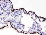 Mesothelin Antibody in Immunohistochemistry (Paraffin) (IHC (P))