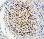 MTA1 Antibody in Immunohistochemistry (Paraffin) (IHC (P))