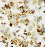 MTCO1 Antibody in Immunocytochemistry (ICC/IF)