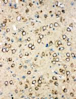 MTCO1 Antibody in Immunohistochemistry (Paraffin) (IHC (P))