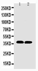 MTCO1 Antibody in Western Blot (WB)