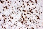 MUC5AC Antibody in Immunohistochemistry (Paraffin) (IHC (P))