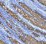 MUC5AC Antibody in Immunohistochemistry (Paraffin) (IHC (P))