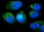 MUT Antibody in Immunocytochemistry (ICC/IF)