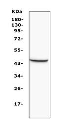 MVD Antibody in Western Blot (WB)