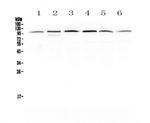 MVP Antibody in Western Blot (WB)