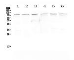 MVP Antibody in Western Blot (WB)