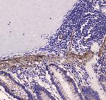 MYLK Antibody in Immunohistochemistry (Paraffin) (IHC (P))