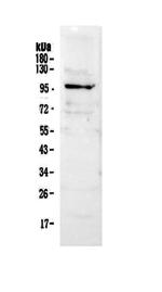 NFATC2 Antibody in Western Blot (WB)