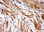 IkB beta Antibody in Immunohistochemistry (Paraffin) (IHC (P))