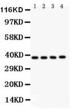 IkB beta Antibody in Western Blot (WB)