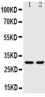 Kallikrein 1 Antibody in Western Blot (WB)