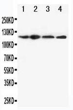 NLRP3 Antibody in Western Blot (WB)