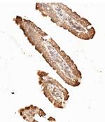 NME2 Antibody in Immunohistochemistry (Paraffin) (IHC (P))