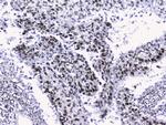 NONO Antibody in Immunohistochemistry (Paraffin) (IHC (P))