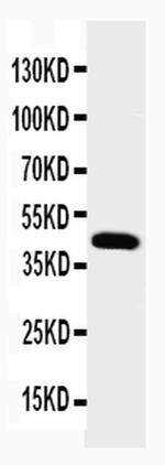 Podocin Antibody in Western Blot (WB)