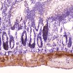 ANP Antibody in Immunohistochemistry (Paraffin) (IHC (P))