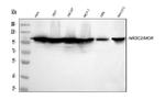 NR3C2 Antibody in Western Blot (WB)