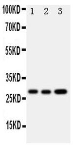 Oncostatin M Antibody in Western Blot (WB)