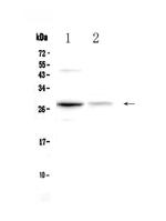 Oncostatin M Antibody in Western Blot (WB)