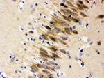 Otoferlin Antibody in Immunohistochemistry (Paraffin) (IHC (P))