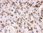 Otoferlin Antibody in Immunohistochemistry (Paraffin) (IHC (P))