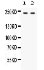 Otoferlin Antibody in Western Blot (WB)