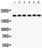 PAPPA Antibody in Western Blot (WB)