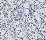 PDCD4 Antibody in Immunohistochemistry (Paraffin) (IHC (P))