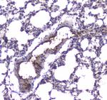 PDE4D Antibody in Immunohistochemistry (Paraffin) (IHC (P))