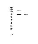 PDE4D Antibody in Western Blot (WB)