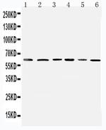 PDK1 Antibody in Western Blot (WB)