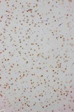 PDK2 Antibody in Immunohistochemistry (Paraffin) (IHC (P))