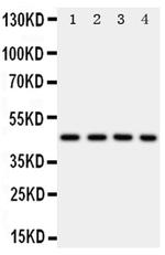 PDK2 Antibody in Western Blot (WB)