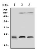 Profilin 2 Antibody in Western Blot (WB)