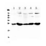 PGF Antibody in Western Blot (WB)