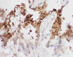 PGK1 Antibody in Immunohistochemistry (Paraffin) (IHC (P))