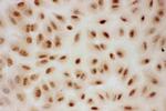 PIAS1 Antibody in Immunocytochemistry (ICC/IF)